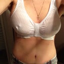 One wk post op! See the boobie on the right that's the one I'm having pain! Hematoma blood clot! Infection!