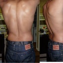 Preop #2, the day prior to the surgery.