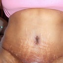 6 week front view, wish I could get rid of the stretch marks