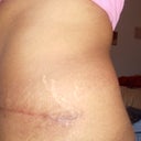 6 weeks left side