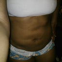 Month 1
Lumps and bumps on belly, doctor says they will go away