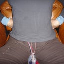 2 days PO with shirt on, drains sitting by my crotch