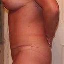 left side 10wks