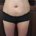 Front view before TT.