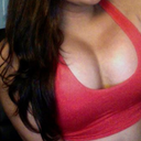 6 days post op. still swollen and a little bit high but its started to set in place little by little everyday
