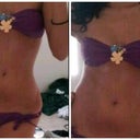 Download the app "surgeon" This is what I am hoping to achieve after the surgery!