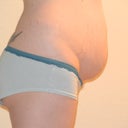 right side