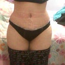 a smaller waist today!!15dpo=))