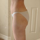 1 1/2 months after