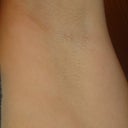 The flash and zoom was on this, I honestly couldn't see the hairs this well in the mirror. Pic was taken same time as above.