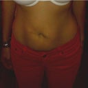 Before surgery