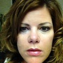 I just received the botox an hour before. FYI  I also received Juvederm around my nasolabial folds. So I am a little swollen.  Notice the forehead line, and crows feet area.  That is where I received the botox.