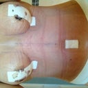 3 days post op - morning