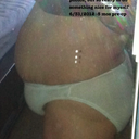 pre-op June 2012
