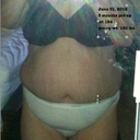 pre-op June 2012
