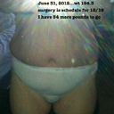 pre-op June 2012