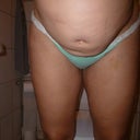 10/18/12 pre op pic 6, front bend/bow