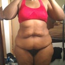 My disgusting stomach!! I plan to loose about another 10 pounds before surgery due to my training for the marathon.