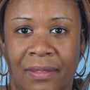 35 Year-Old-Woman Desires A Thinner Nose