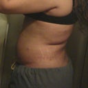 8 days later