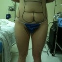 On the day of surgery this is my front pre-op photo.