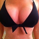 6 weeks post op