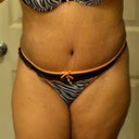 19 days post opt! I always hated this outfit but it looks great now!