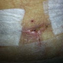 Open stitch
