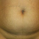 Preop photos number 1