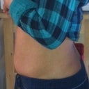 Preop photo number 2