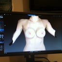 This is the Vectra Image that the doctor was able to create at my consultation.  This is approximately what I am hoping to achieve (2D image so it looks a little smashed.