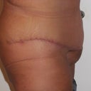 You can see here how it is round and low its not flat like it was last week