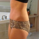 5 1/2 weeks post-op (38 days) profile.  Photo taken first thing in morning.