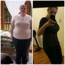 6 years PO lap-band, 3 weeks PO tummy tuck & breast lift/aug