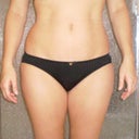 2 Weeks Post Surgery - Flanks (front view)