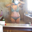 3 weeks post op mommy makeover