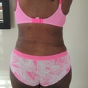 1 week PO (back)