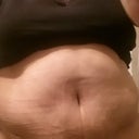 Another 28 day pic. And these are morning pics. We all know swelling is less in the a.m. UG!