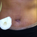 I was a little worried about my belly button but not anymore!!