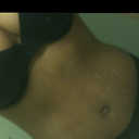 4 weeks post op