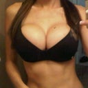 2 1/2 months post op, bra is too small so I'm spilling out of it a little but makes them look bigger even though I went down in size
