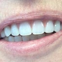 My fab teeth