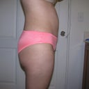 8 months post op