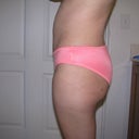 8 months post op