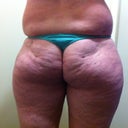 FYI my undies are not too tight.. even without them this is what it looks like.