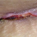 Another pic.. Eeekk! :(   3 weeks 2 days