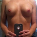 5 weeks post op