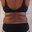 Before Back