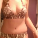 10.5 weeks post op (late afternoon, slightly swollen)