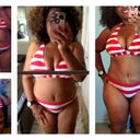 Before, week 1 post op  and 3 weeks post op